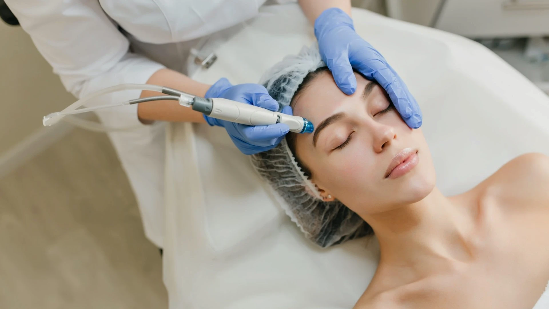 Top 10 Benefits of Chemical Peel Treatments for Glowing Skin